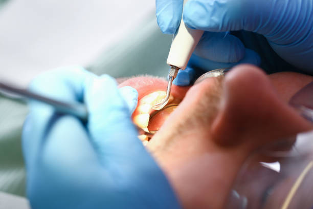 Best Emergency Treatment for Toothache in Benton Harbor, MI