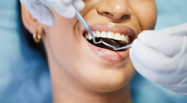 Best Emergency Tooth Extraction in Benton Harbor, MI