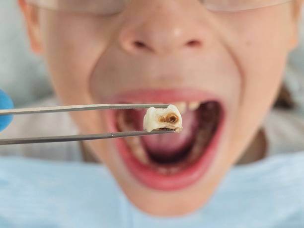 Best Walk-In Emergency Dentist in Benton Harbor, MI